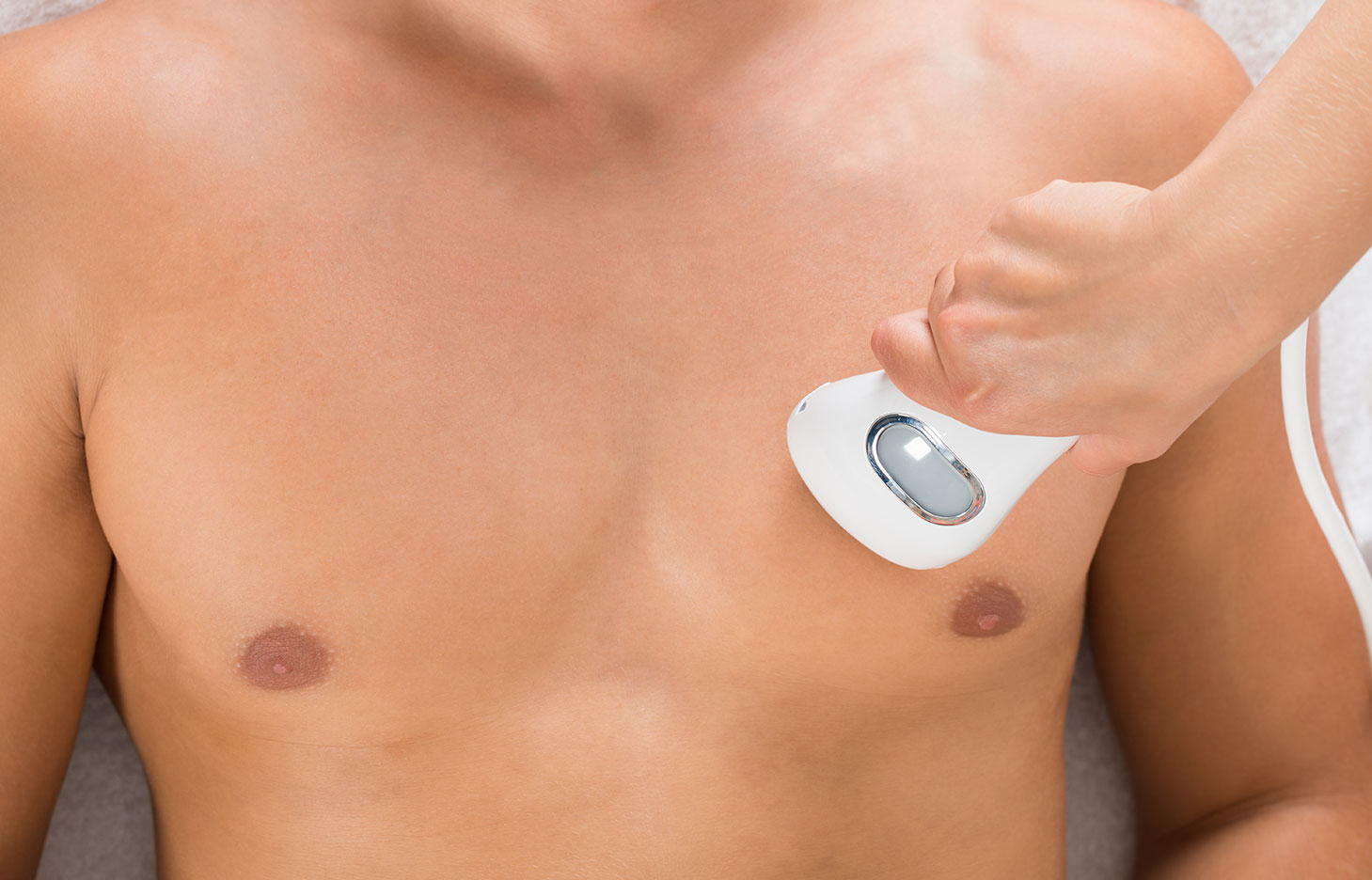 Epilation definitive Hommes Opio